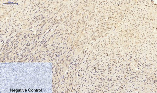 IHC - p38 Polyclonal Antibody AP71696